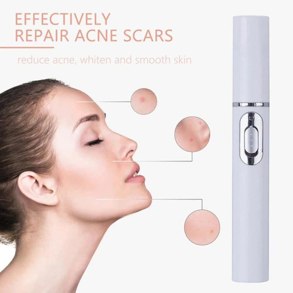 Blue light acne therapy pen by Everyday Auraa, LED skin treatment device for scars, wrinkles, and acne management.