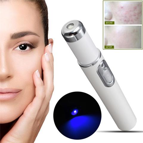 Blue light acne therapy pen from Everyday Auraa, LED skin treatment device for scars, wrinkles, and acne, shown in close-up.